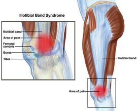 knee-img5