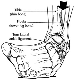 footer1