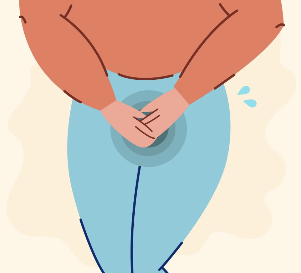 Understanding Stress Urinary Incontinence 