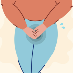 Understanding Stress Urinary Incontinence 